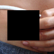 Illustration for article titled Man Grows New Fingertip On His Stomach (Warning: Gross)